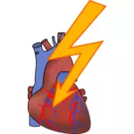 心臓発作のベクトル描画のための記号