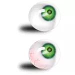 Globo ocular verde