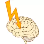 Vektor image for hjerneslag